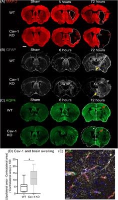 Caveolin-1 Regulates Perivascular Aquaporin-4 Expression After Cerebral Ischemia